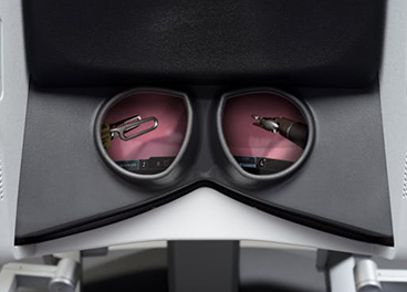 מערכת ראיה תלת ממדית של רובוט דה וינצ'י- Da Vinci surgery